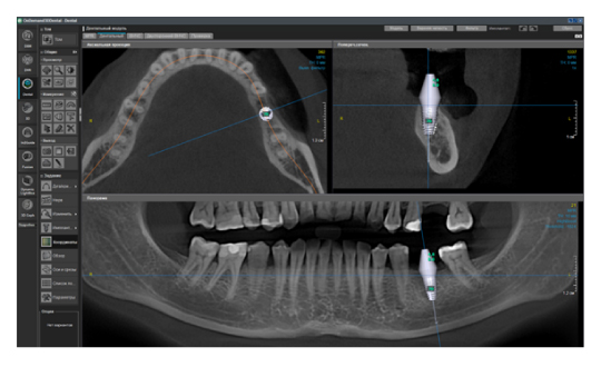 Критерии выбора конусно-лучевого компьютерного томографа.-08 (1).jpg