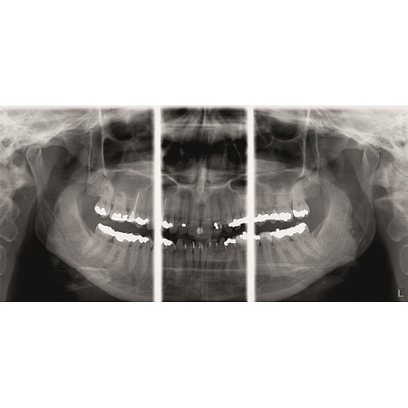 KaVo Pan eXam Plus 3D Ceph - универсальный датчик Pan/Ceph для панорамной томографии, цефалостат, функция 3D-томографии 6x8 см