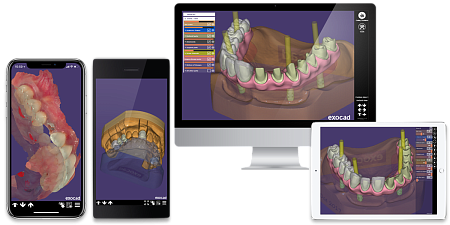 EXOCAD - программа моделирования для CADсистем