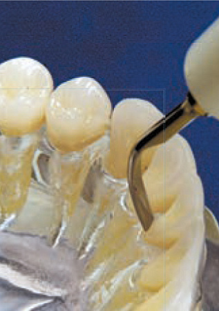 Acteon насадка №2 – Мощная насадка для скайлинга