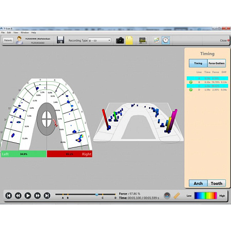 Tekscan T-Scan Core - аппарат для цифрового анализа окклюзии