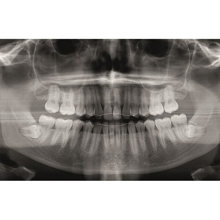 KaVo Pan eXam Plus 3D Ceph - универсальный датчик Pan/Ceph для панорамной томографии, цефалостат, функция 3D-томографии 6x8 см