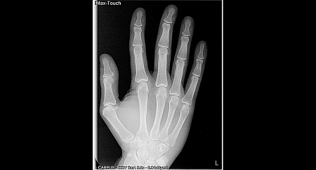 Owandy I-Max Touch 3D Ceph – Конусно-лучевой томограф 9х8