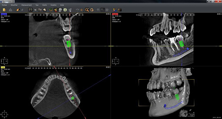 Owandy I-Max Touch 3D – Конусно-лучевой томограф 9х8
