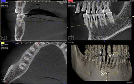 Owandy I-Max Touch 3D Ceph – Конусно-лучевой томограф 9х8