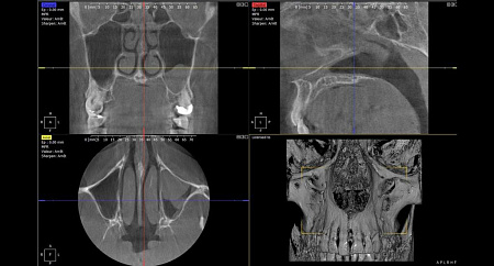 Owandy I-Max Touch 3D – Конусно-лучевой томограф 9х8